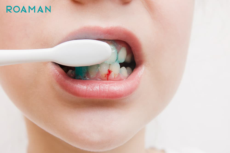 Chảy máu chân răng có thể là dấu hiệu cho thấy nướu không được chăm sóc đúng cách