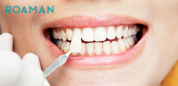 Dán veneers nha khoa là cách phục hồi men răng được nhiều người áp dụng