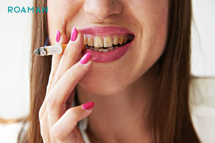Hút thuốc được cho là nguyên nhân hàng đầu khiến răng hư tổn