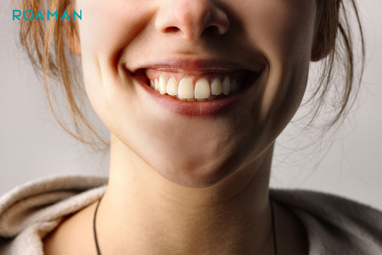 Đốm trắng trên răng là một dạng đổi màu trên răng